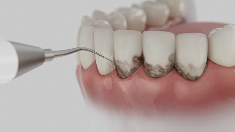 Reliable Emergency Dentist contractor in Hunter, OH by Smile Center Dentistry